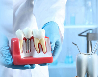 Dental Implants for Single Tooth Replacement: Why It Matters 